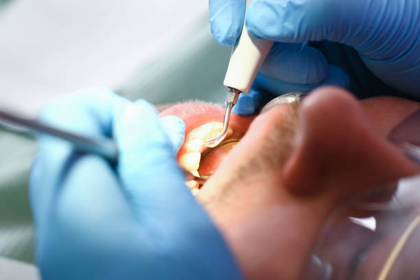 Best Cosmetic Emergency Dentistry in Kdeer, IL